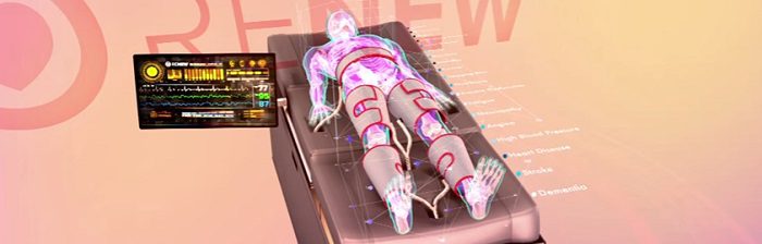 Stage 2 Innovations - Renew (CGI)